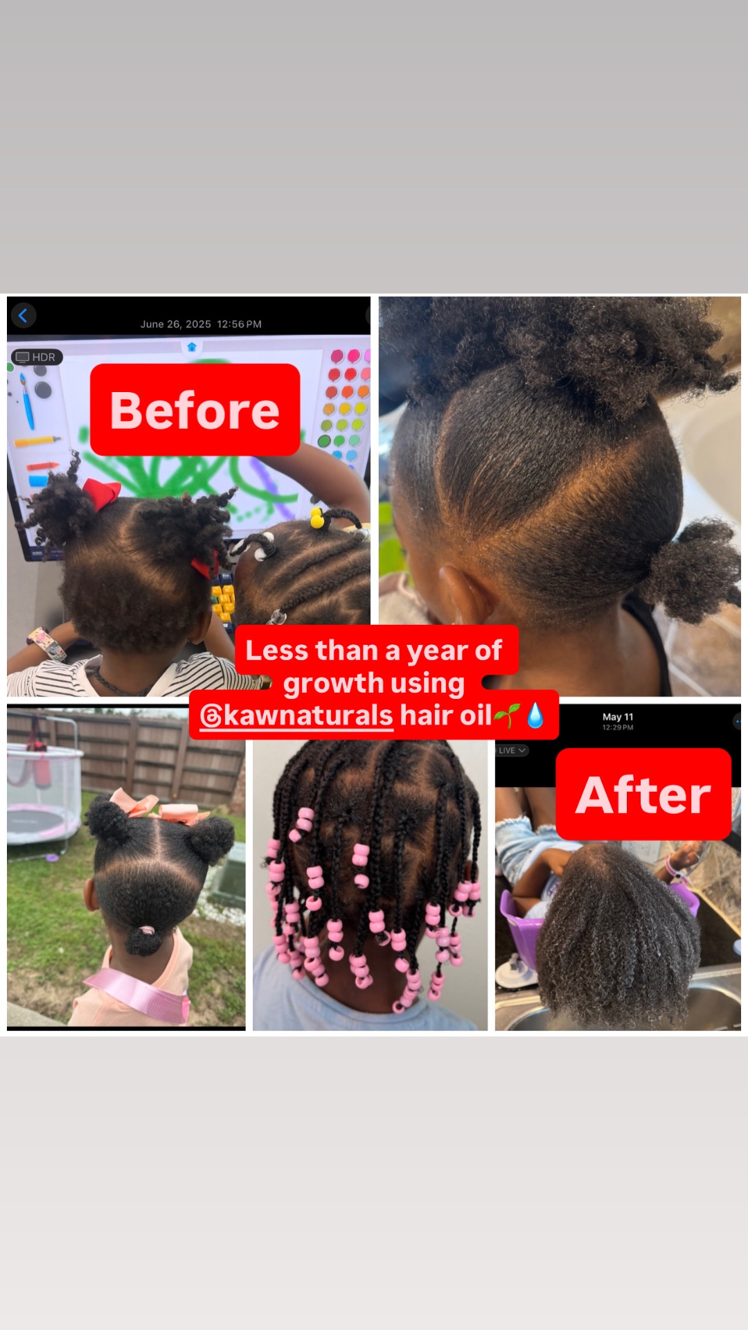 Less than a year of growth using kawnaturals hair oil