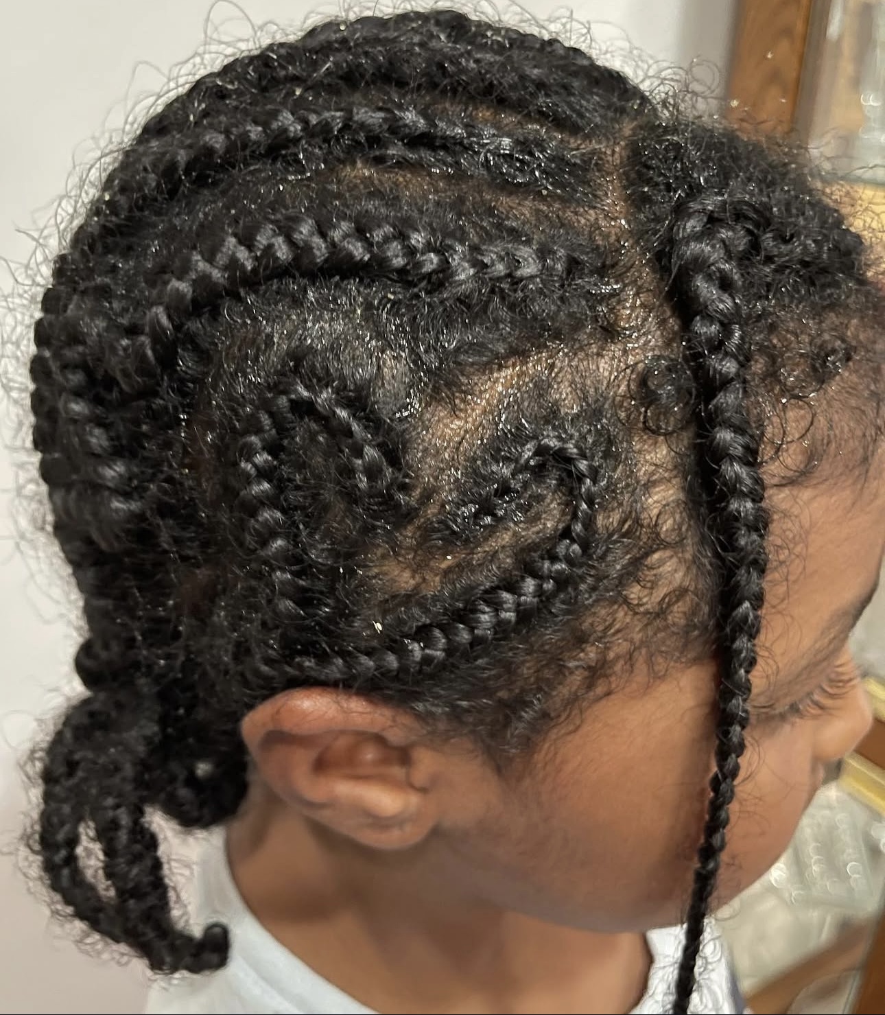 Healthy scalp and braids